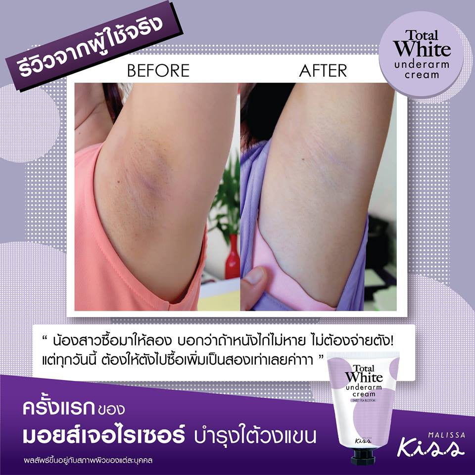 Malissa Kiss Total White 腋下美白霜30ml